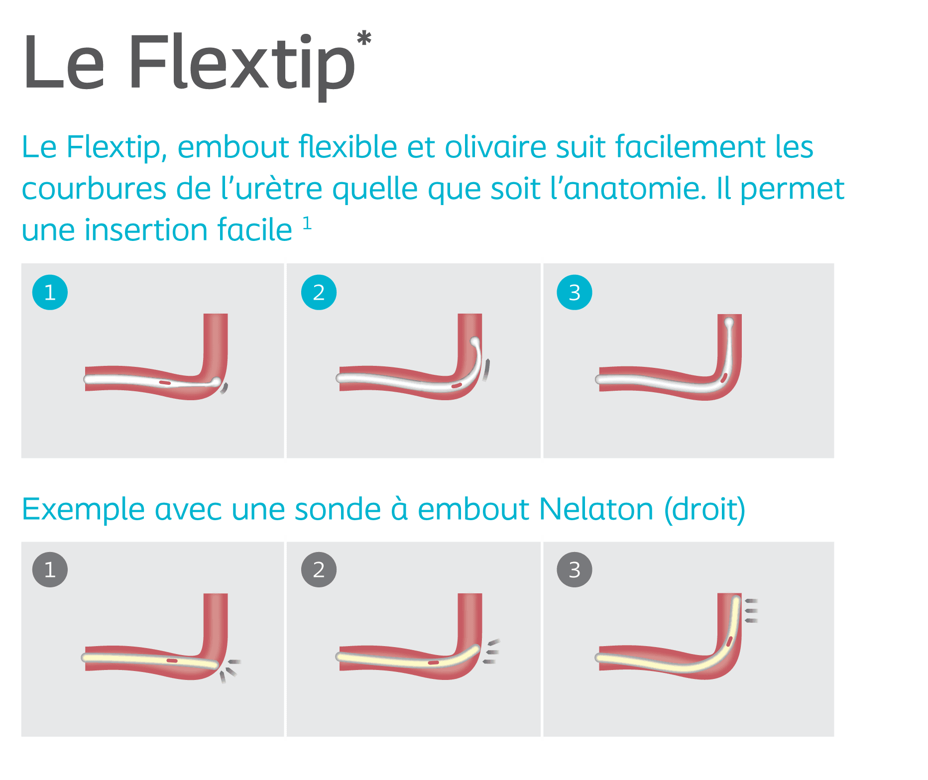 Pose d'une sonde urinaire - Revinax